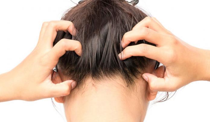 How To Fight Dandruff In The Winter Bebeautiful
